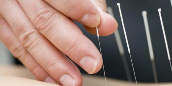 Acupuncture degree in CT